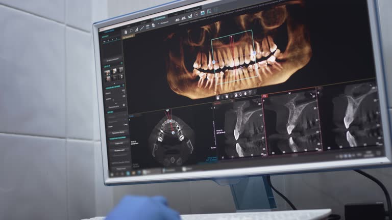 Oral Cancer Screening